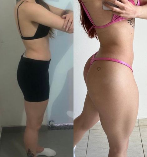 Resultados glúteos e coxas